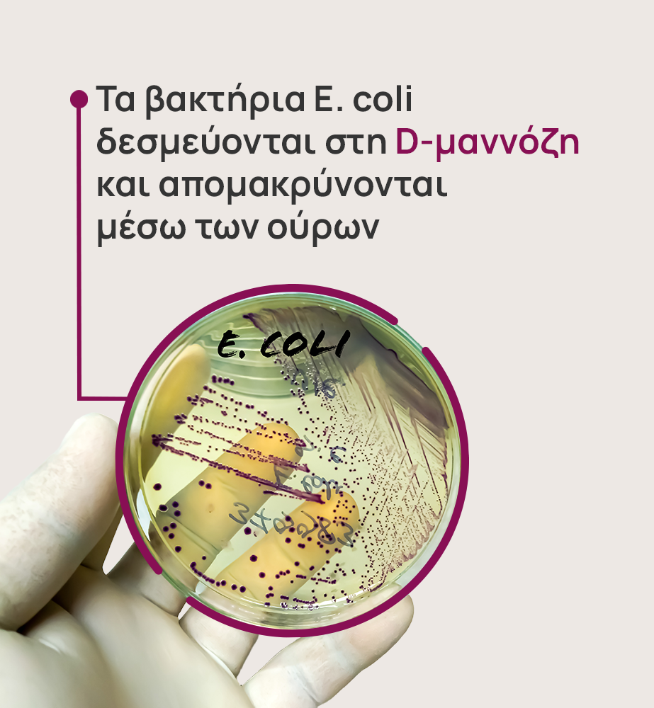 Τρυβλίο όπου φαίνεται μια καλλιέργεια E. coli, εντερικού βακτηρίου που αποτελεί τη συχνότερη αιτία ουρολοιμώξεων, σε ποσοστό σχεδόν 90%.